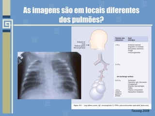 As imagens são em locais diferentes  dos pulmões?  Taussig,2008 