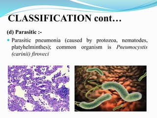 CLASSIFICATION cont…
(d) Parasitic :-
 Parasitic pneumonia (caused by protozoa, nematodes,
platyhelminthes); common organism is Pneumocystis
(carinii) firoveci
 