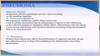 -_ PNEUMONIA _slideshare | PPTX