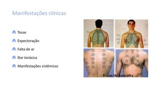 Manifestações clínicas
Tosse
Expectoração
Falta de ar
Dor torácica
Manifestações sistêmicas
 