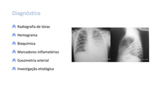 Diagnóstico
Radiografia de tórax
Hemograma
Bioquímica
Marcadores inflamatórios
Gasometria arterial
Investigação etiológica
 