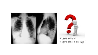  Como tratar?
 Como saber a etiologia?
 