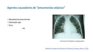 Agentes causadores de “pneumonias atípicas”
 Mycoplasma pneumoniae
 Chlamydia spp.
 Virus
etc
Mandell, Principles and Practice of Infectious Diseases, 8th ed., 2015
Pneumonia por Mycoplasma, sorologia positiva
 