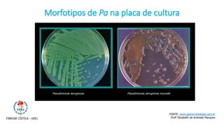 Pseudomonas aeruginosa Pseudomonas aeruginosa mucoide
Morfotipos de Pa na placa de cultura
FONTE: www.pgmicrobiologia.uerj.br
Profa Elizabeth de Andrade MarquesFIBROSE CÍSTICA - UERJ
 
