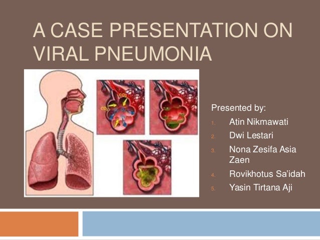 pneumonia case study slideshare