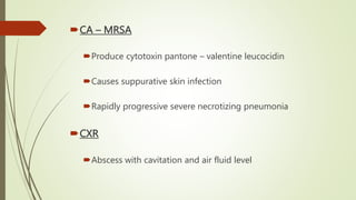 CA – MRSA
Produce cytotoxin pantone – valentine leucocidin
Causes suppurative skin infection
Rapidly progressive severe necrotizing pneumonia
CXR
Abscess with cavitation and air fluid level
 
