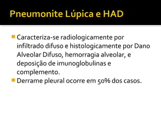  Caracteriza-se radiologicamente por
infiltrado difuso e histologicamente por Dano
Alveolar Difuso, hemorragia alveolar, e
deposição de imunoglobulinas e
complemento.
 Derrame pleural ocorre em 50% dos casos.
 