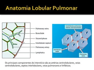 Os principais componentes do interstício são as artérias centrolobulares, veias
centrolobulares, septos interlobulares, veias pulmonares e linfáticos.
 