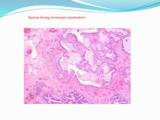 Pneumosclerosis Pneumosclerosis | PPTX