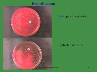 Not  optochin sensitive optochin sensitive Identification www.freelivedoctor.com 