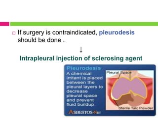  If surgery is contraindicated, pleurodesis
should be done .
↓
Intrapleural injection of sclerosing agent
 