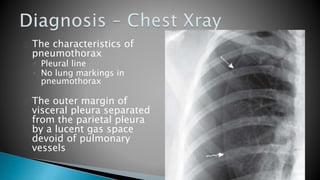 The characteristics of 
pneumothorax 
◦ Pleural line 
◦ No lung markings in 
pneumothorax 
The outer margin of 
visceral pleura separated 
from the parietal pleura 
by a lucent gas space 
devoid of pulmonary 
vessels 
 