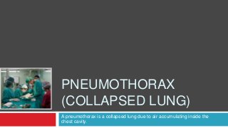 A pneumothorax is a collapsed lung due to air accumulating inside the
chest cavity.
PNEUMOTHORAX
(COLLAPSED LUNG)
 