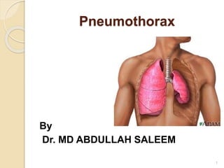 Pneumothorax
By
Dr. MD ABDULLAH SALEEM
1
 