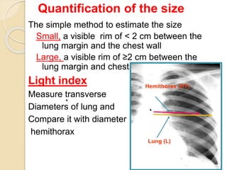 Quantification of the size
The simple method to estimate the size
Small, a visible rim of < 2 cm between the
lung margin and the chest wall
Large, a visible rim of ≥2 cm between the
lung margin and chest wall
Light index
Measure transverse
Diameters of lung and
Compare it with diameter
hemithorax
22
22
Hemithorax (HT)
Lung (L)
 