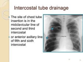 36
36
 The site of chest tube
insertion is in the
midclavicular line of
second and third
intercostal
 or anterior axillary line
of fifth and sixth
intercostal
Intercostal tube drainage
 