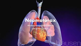 Neumotórax
Almanza ortega Thalia Andrea
5to grado Grupo D
 