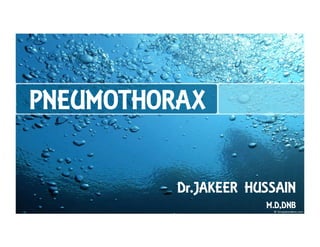 PNEUMOTHORAX
Dr.JAKEER HUSSAIN
M.D,DNB
 
