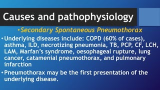 Causes and pathophysiology
•Secondary Spontaneous Pneumothorax
•Underlying diseases include: COPD (60% of cases),
asthma, ILD, necrotizing pneumonia, TB, PCP, CF, LCH,
LAM, Marfan’s syndrome, oesophageal rupture, lung
cancer, catamenial pneumothorax, and pulmonary
infarction
•Pneumothorax may be the first presentation of the
underlying disease.
 