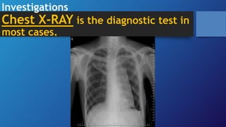 Investigations
Chest X-RAY is the diagnostic test in
most cases.
 