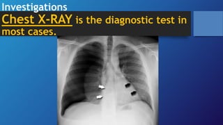 Investigations
Chest X-RAY is the diagnostic test in
most cases.
 