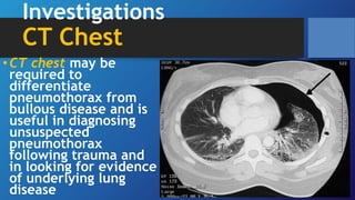 Investigations
CT Chest
•CT chest may be
required to
differentiate
pneumothorax from
bullous disease and is
useful in diagnosing
unsuspected
pneumothorax
following trauma and
in looking for evidence
of underlying lung
disease
 