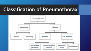Classification of Pneumothorax
 
