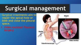 Surgical management
• Surgical treatments aim to
repair the apical hole or
bleb and close the pleural
space.
1. Video Assisted Thoracic
Surgery
 