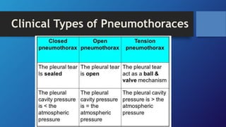 Clinical Types of Pneumothoraces
 