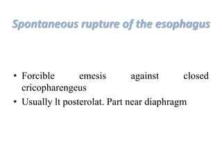 Spontaneous rupture of the esophagus
• Forcible emesis against closed
cricopharengeus
• Usually lt posterolat. Part near diaphragm
 