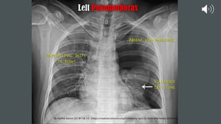 By Karthik Easvur [CC BY-SA 3.0 (https://creativecommons.org/licenses/by-sa/3.0)], from Wikimedia Commons
 