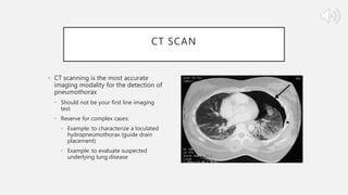 CT SCAN
• CT scanning is the most accurate
imaging modality for the detection of
pneumothorax
• Should not be your first line imaging
test
• Reserve for complex cases:
• Example: to characterize a loculated
hydropneumothorax (guide drain
placement)
• Example: to evaluate suspected
underlying lung disease
 