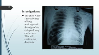 Investigations:
 The chest X-ray
shows absence
of lung
markings and
the edge of the
collapsed lung
can be seen.
This will
confirm the
diagnosis.
12
 
