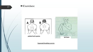Exercises:17
 