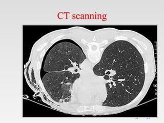 34
34
CT scanning
 