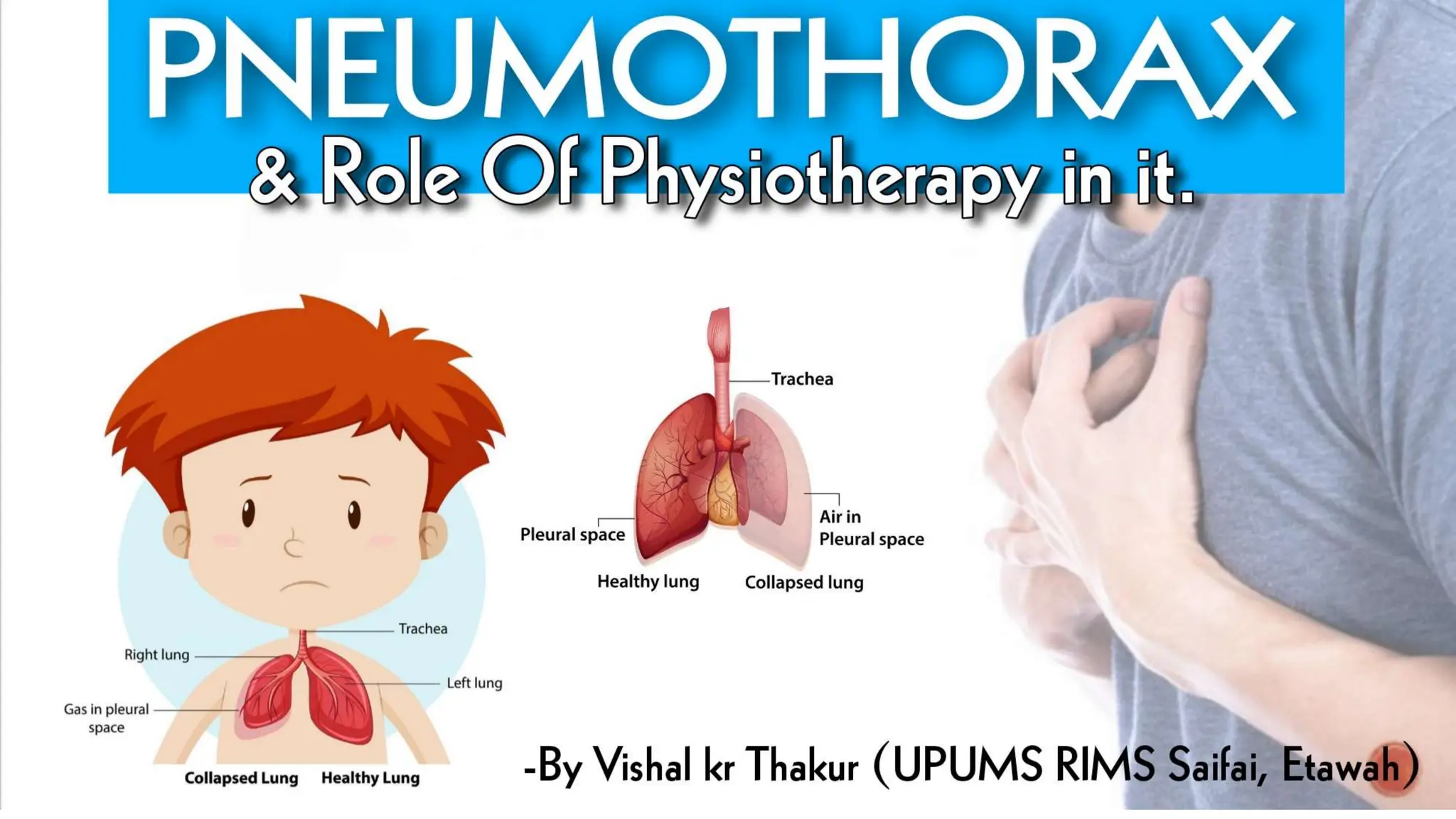 Pneumothorax and role of Physiotherapy in it. PPT