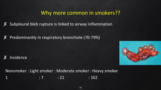Why more common in smokers??
✘ Subpleural bleb rupture is linked to airway inflammation
✘ Predominantly in respiratory bronchiole (70-79%)
✘ Incidence
Nonsmoker : Light smoker : Moderate smoker : Heavy smoker
1 : 7 : 21 : 102
35
 