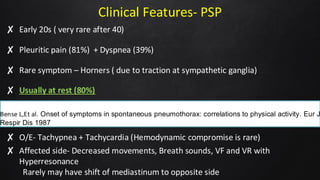 Clinical Features- PSP
✘ Early 20s ( very rare after 40)
✘ Pleuritic pain (81%) + Dyspnea (39%)
✘ Rare symptom – Horners ( due to traction at sympathetic ganglia)
✘ Usually at rest (80%)
✘ O/E- Tachypnea + Tachycardia (Hemodynamic compromise is rare)
✘ Affected side- Decreased movements, Breath sounds, VF and VR with
Hyperresonance
Rarely may have shift of mediastinum to opposite side
Bense L,Et al. Onset of symptoms in spontaneous pneumothorax: correlations to physical activity. Eur J
Respir Dis 1987
 