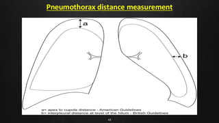 Pneumothorax distance measurement
43
 