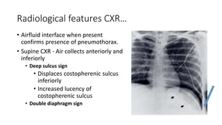 Radiological features CXR… 
• Airfluid interface when present 
confirms presence of pneumothorax. 
• Supine CXR - Air collects anteriorly and 
inferiorly 
• Deep sulcus sign 
• Displaces costopherenic sulcus 
inferiorly 
• Increased lucency of 
costopherenic sulcus 
• Double diaphragm sign 
 
