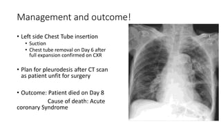 Management and outcome! 
• Left side Chest Tube insertion 
• Suction 
• Chest tube removal on Day 6 after 
full expansion confirmed on CXR 
• Plan for pleurodesis after CT scan 
as patient unfit for surgery 
• Outcome: Patient died on Day 8 
Cause of death: Acute 
coronary Syndrome 
 