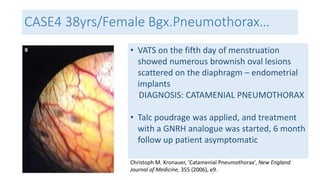 CASE4 38yrs/Female Bgx.Pneumothorax… 
• VATS on the fifth day of menstruation 
showed numerous brownish oval lesions 
scattered on the diaphragm – endometrial 
implants 
DIAGNOSIS: CATAMENIAL PNEUMOTHORAX 
• Talc poudrage was applied, and treatment 
with a GNRH analogue was started, 6 month 
follow up patient asymptomatic 
Christoph M. Kronauer, 'Catamenial Pneumothorax', New England 
Journal of Medicine, 355 (2006), e9. 
 
