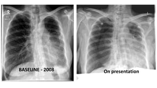 BASELINE - 2008 On presentation 
 