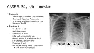CASE 5. 34yrs/Indonesian 
• Diagnosis 
• Secondary spontaneous pneumothorax 
• Community Acquired Pneumonia 
• To work up for underlying Chronic Lung 
Disease – TRO TB 
• Treatment 
• Chest drain in ED 
• High flow oxygen 
• Monitoring in HDW 
• Fetal well being monitoring. 
• Gumco suction 5cm H2o from day 2 
• Subcutaneous emphysema - 
• Persisting air leak 
• Discharged on Day 10 with pneumostat 
• Early review in Clinic Day 16 
Day 8 admission 
 
