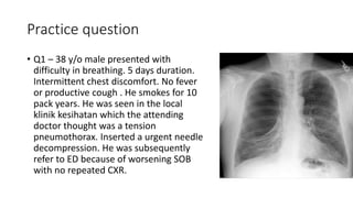 Practice question 
• Q1 – 38 y/o male presented with 
difficulty in breathing. 5 days duration. 
Intermittent chest discomfort. No fever 
or productive cough . He smokes for 10 
pack years. He was seen in the local 
klinik kesihatan which the attending 
doctor thought was a tension 
pneumothorax. Inserted a urgent needle 
decompression. He was subsequently 
refer to ED because of worsening SOB 
with no repeated CXR. 
 