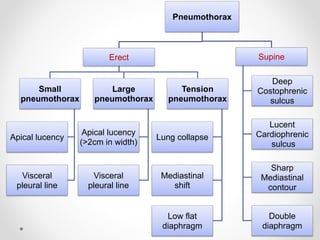 Pneumothorax
Erect
Small
pneumothorax
Apical lucency
Visceral
pleural line
Large
pneumothorax
Apical lucency
(>2cm in width)
Visceral
pleural line
Tension
pneumothorax
Lung collapse
Mediastinal
shift
Low flat
diaphragm
Supine
Deep
Costophrenic
sulcus
Lucent
Cardiophrenic
sulcus
Sharp
Mediastinal
contour
Double
diaphragm
 