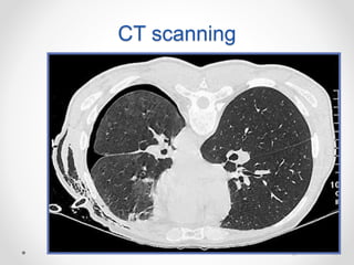 4747
CT scanning
 