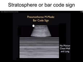 Stratosphere or bar code sign
 