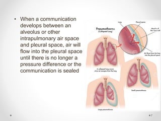 • When a communication
develops between an
alveolus or other
intrapulmonary air space
and pleural space, air will
flow into the pleural space
until there is no longer a
pressure difference or the
communication is sealed
7
 