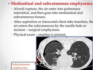 93
 Mediastinal and subcutaneous emphysema
◦ Alveoli rupture, the air enter into pulmonary
interstitial, and then goes into mediastinal and
subcutaneous tissues.
◦ After aspiration or intercostal chest tube insertion, the
air enters the subcutaneous by the needle hole or
incision – surgical emphysema
◦ Physical exam – crepitus is present.
Subcutaneous
emphysema
 